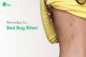Image result for bed bug bites