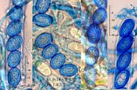 Attēlu rezultāti vaicājumam “Sowerbyella radiculata”