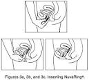 NuvaRing (Organon USA), Drug Reference Encyclopedia