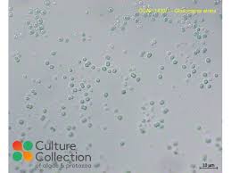 Attēlu rezultāti vaicājumam “Gloeocapsa rupestris”