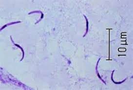 Attēlu rezultāti vaicājumam “Enteridium variabile plasmodium”