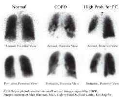 Image result for  v    q