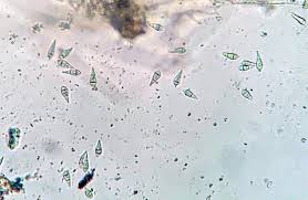 Attēlu rezultāti vaicājumam “Licea pygmaea spores”