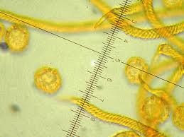 Attēlu rezultāti vaicājumam “Oligonema persimile macro”