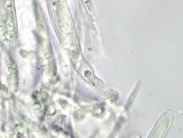 Attēlu rezultāti vaicājumam “Lachnum corticale”