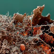 Attēlu rezultāti vaicājumam “Trichia flavicoma spores”