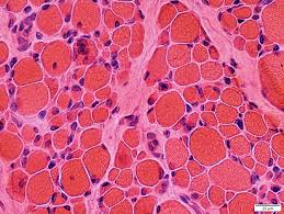 Attēlu rezultāti vaicājumam “Tetanops myopina”