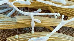 Attēlu rezultāti vaicājumam “Badhamia bethelii spores”