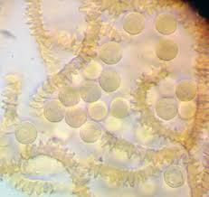 Attēlu rezultāti vaicājumam “Heterotrichia pomiformis (syn. Arcyria pomiformis)”