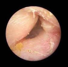 Image result for Pyle Octopush Club