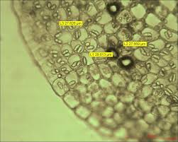 Attēlu rezultāti vaicājumam “Jungermannia sphaerocarpa”