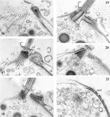 Attēlu rezultāti vaicājumam “Symphytocarpus impexus plasmodium”