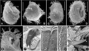 Attēlu rezultāti vaicājumam “Heterotrichia oerstedii (syn. Arcyria oerstedii) young”