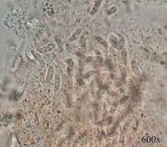 Attēlu rezultāti vaicājumam “Dacrymyces chrysospermus spores”