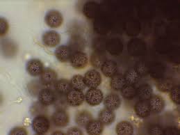 Attēlu rezultāti vaicājumam “Didymium proximum spores”