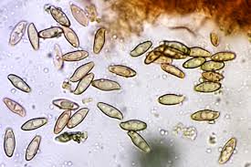 Attēlu rezultāti vaicājumam “Didymium xanthopus spores”