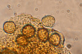 Attēlu rezultāti vaicājumam “Licea minima spores”