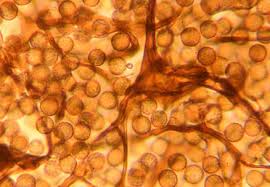 Attēlu rezultāti vaicājumam “Physarum confertum”