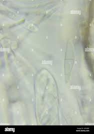 Attēlu rezultāti vaicājumam “Cudoniella acicularis”