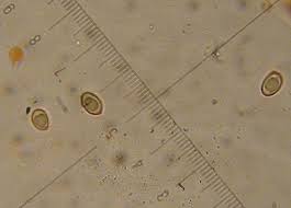 Attēlu rezultāti vaicājumam “Cribraria rubiginosa spores”