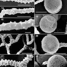 Attēlu rezultāti vaicājumam “Arcyria affinis stalked”