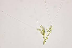 Attēlu rezultāti vaicājumam “Bulbochaete mirabilis”