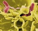 Blog de Patologia: <b>Choque Séptico</b>