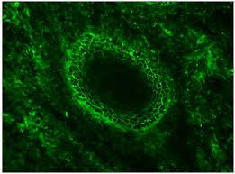 Attēlu rezultāti vaicājumam “Pemphigus borealis”