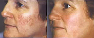 http://t0.gstatic.com/images?q=tbn:ANd9GcQj0gICy88yjGZBWdyIc-TOIDmdKSXpy-k6iAA-VvqNLK3CfdrdLA