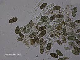 Attēlu rezultāti vaicājumam “Calicium viride”