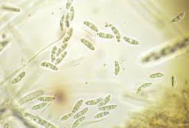 Attēlu rezultāti vaicājumam “Rutstroemia firma”