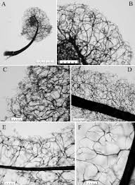 Attēlu rezultāti vaicājumam “Stemonitopsis subcaespitosa spores”