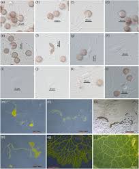Attēlu rezultāti vaicājumam “Physarum flavicomum spores”