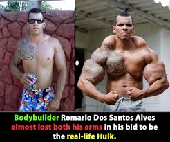 Image result for SYNTHOL