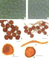 Attēlu rezultāti vaicājumam “Fossombronia foveolata sporophyte”
