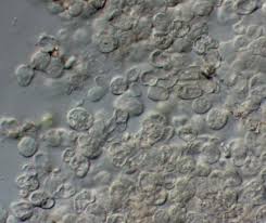 Attēlu rezultāti vaicājumam “Erythricium aurantiacum”