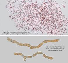 Attēlu rezultāti vaicājumam “Dacrymyces stillatus”