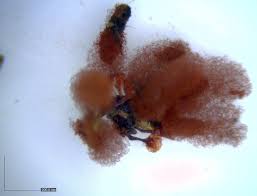 Attēlu rezultāti vaicājumam “Arcyria globosa”