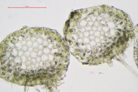 Attēlu rezultāti vaicājumam “Nardia scalaris cells”