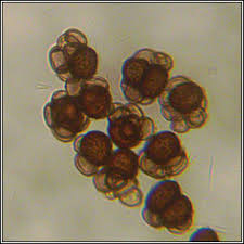 Attēlu rezultāti vaicājumam “Urocystis anemones spores”