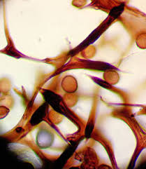 Attēlu rezultāti vaicājumam “Amaurochaete fusiformis spores”