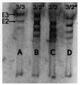 C: homozygous <b>apo E2</b>/2