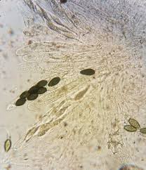 Attēlu rezultāti vaicājumam “Licea pusilla spores”