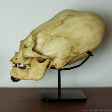 Image result for elongated skulls