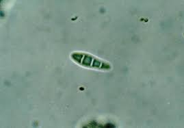 Attēlu rezultāti vaicājumam “Opegrapha atra”