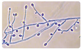 Attēlu rezultāti vaicājumam “Badhamiopsis scripta spores”