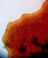 Attēlu rezultāti vaicājumam “Licea pusilla sessile”