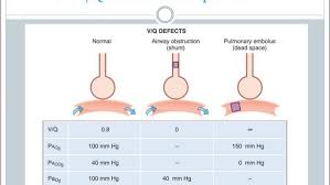 Image result for  v    q