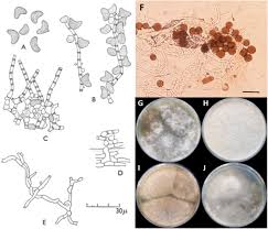 Attēlu rezultāti vaicājumam “Comatricha elegans var. microspora spores”