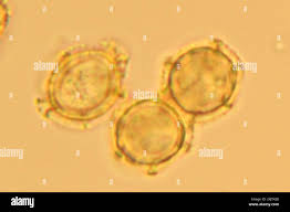 Attēlu rezultāti vaicājumam “Oligonema favogineum”